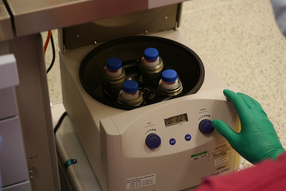 Regenerative cartilage injection prepared at London Cartilage Clinic