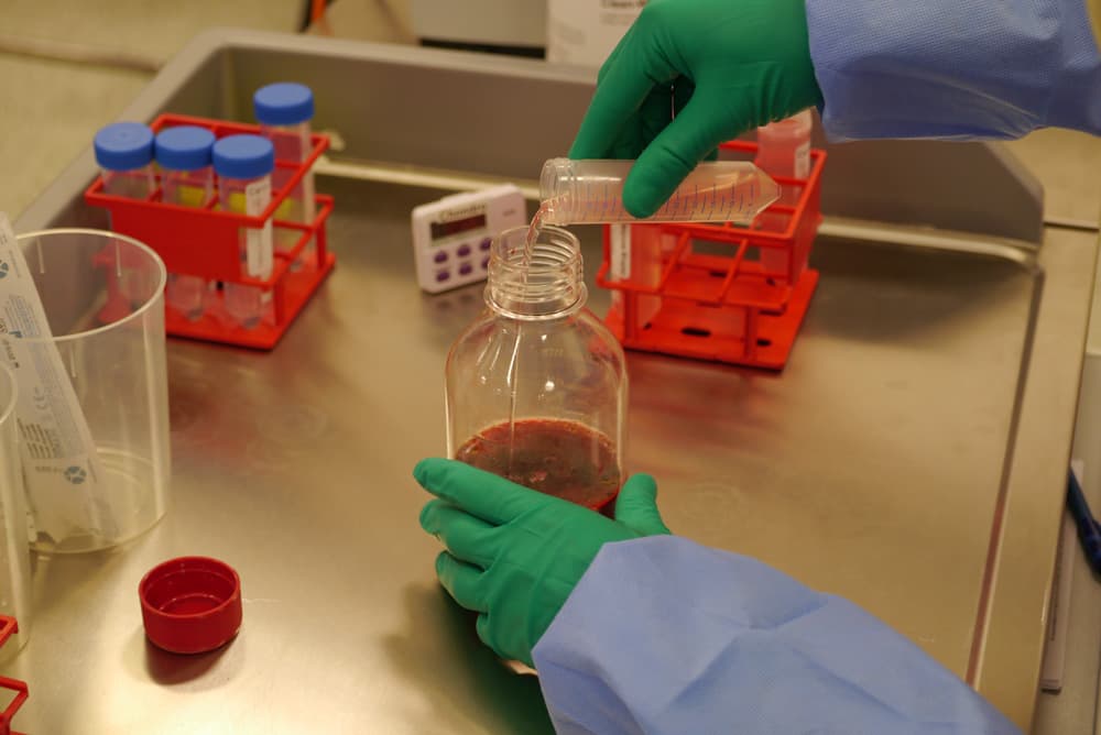 Regenerative micrograft injection prepared at London Cartilage Clinic in London